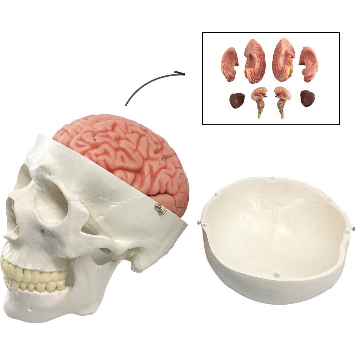 Modelo Anatómico de Cráneo y Cerebro Humano 11 Piezas EVOTECH