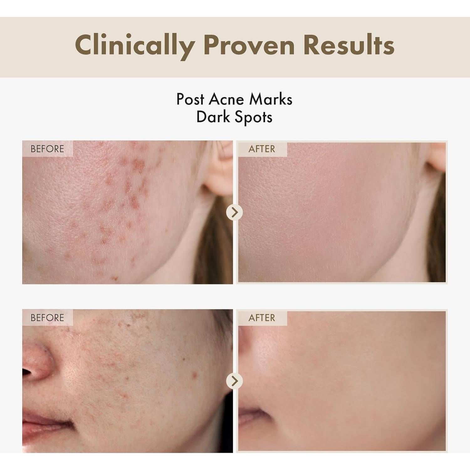 Suero Facial Arbutina Alpha 2% TOSOWOONG 33ml Hidratante