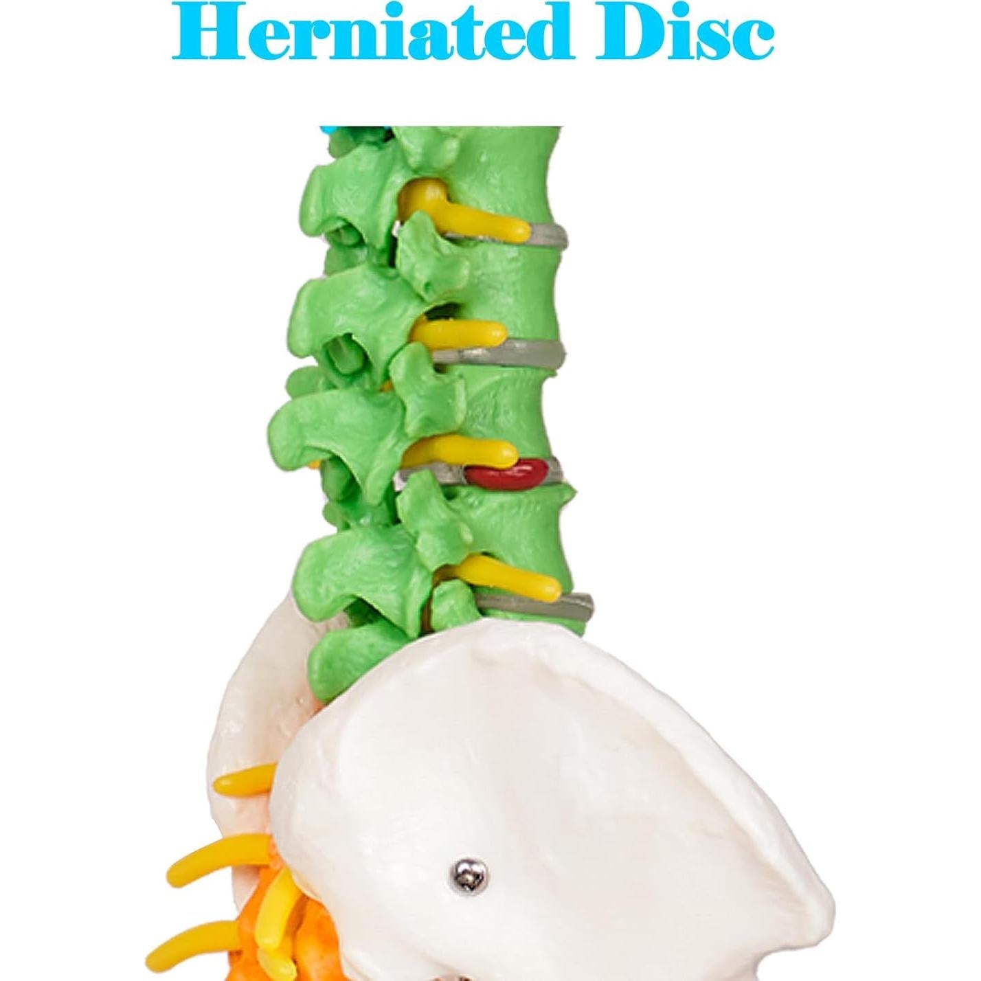 Modelo de Columna Vertebral Mini Breesky 39.37 cm Colorido