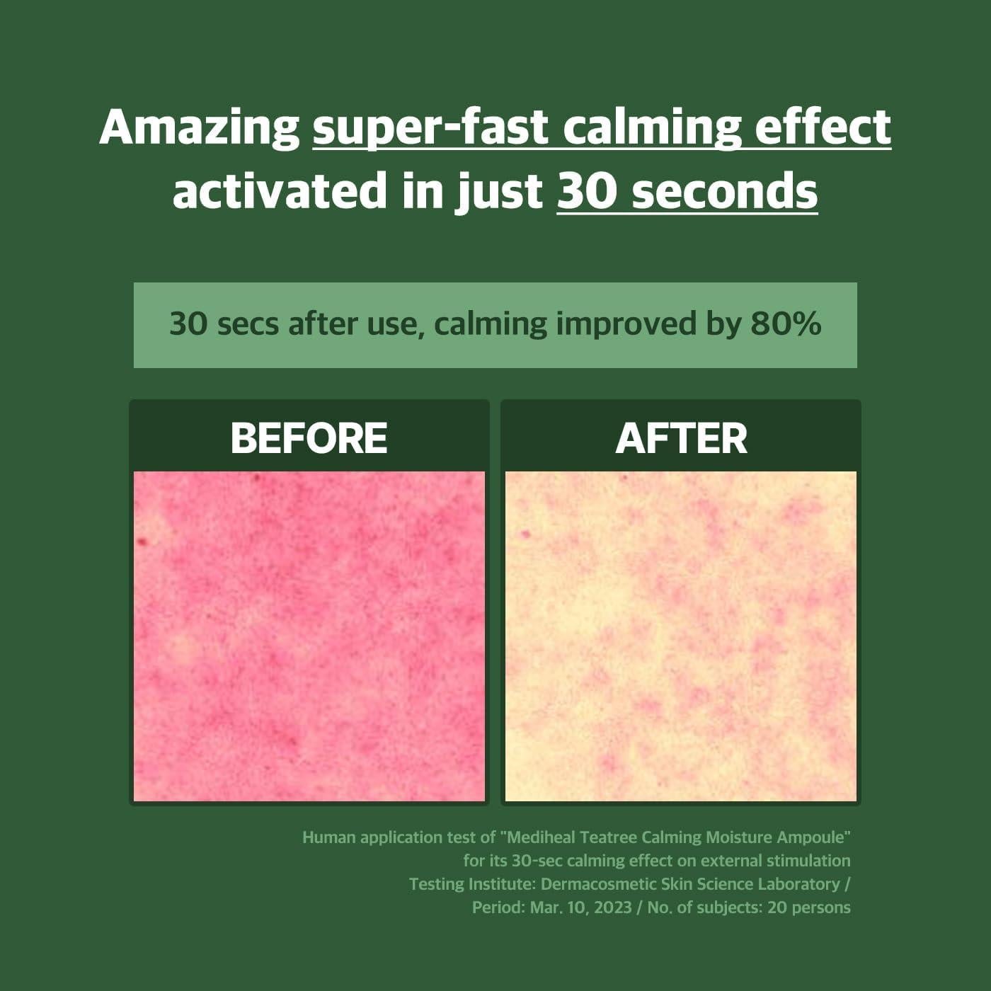 Ampoule Hidratante Mediheal Teatree 50ml - Calma y Hidrata