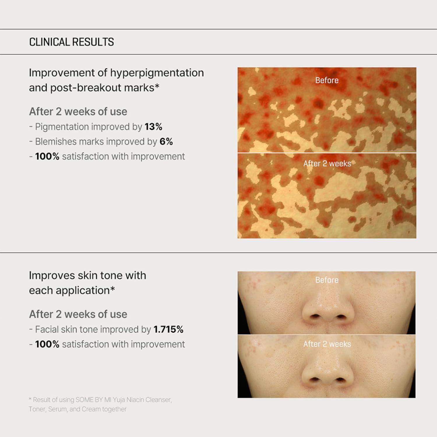 Crema Anti Manchas Yuja Some By Mi - 60ml - 5% Niacinamida