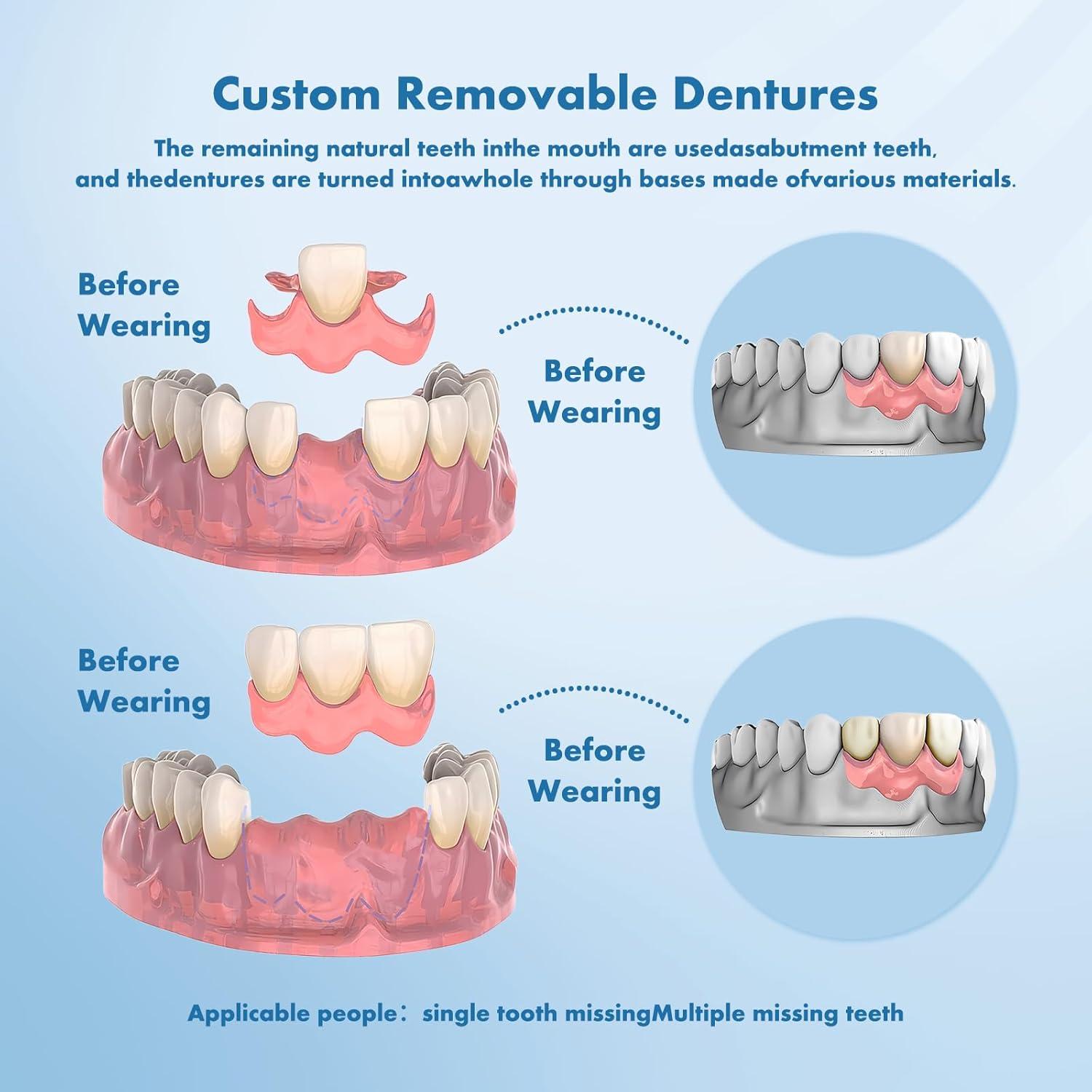 Dentaduras Removibles Personalizadas Qiivosm - 1 Diente