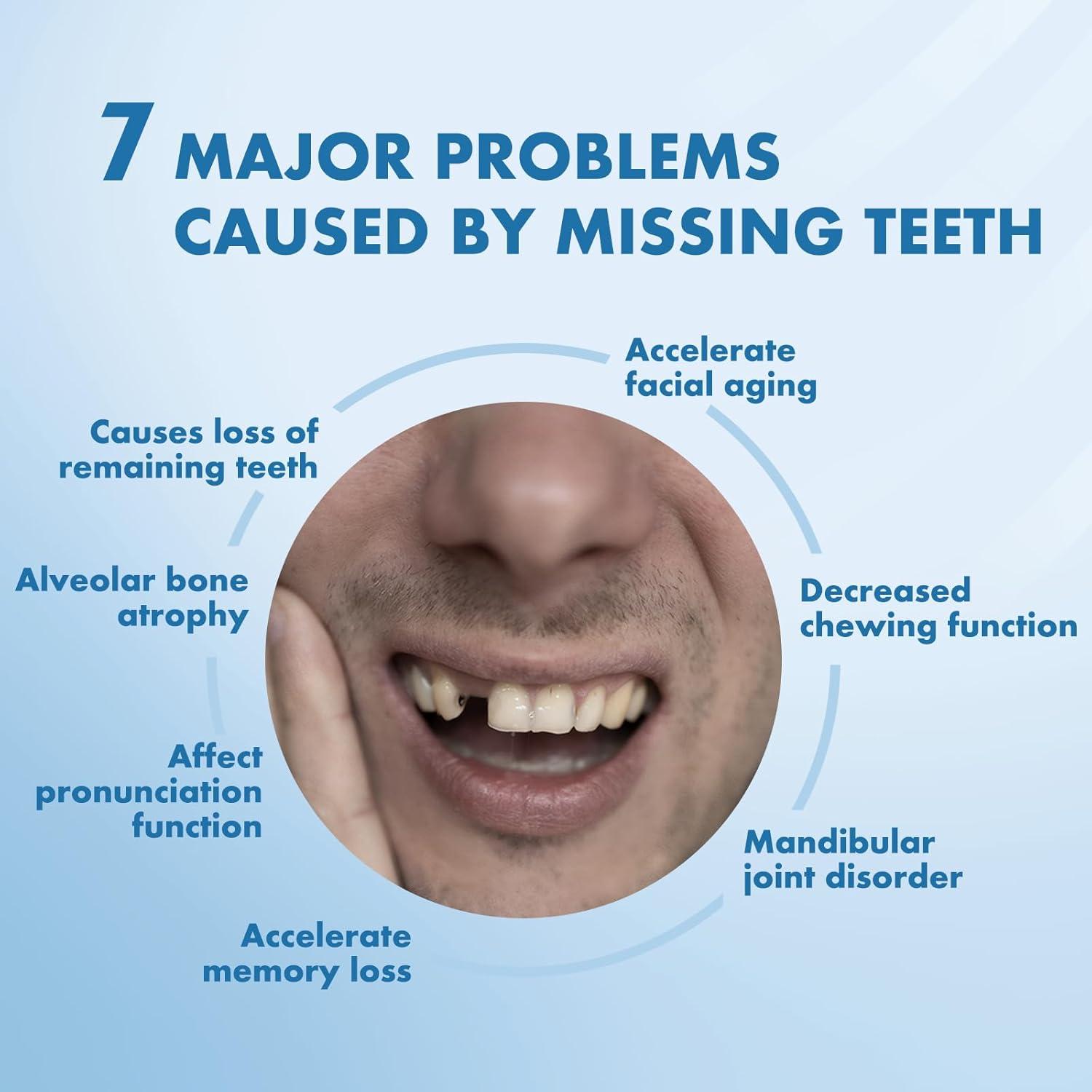 Dentaduras Removibles Personalizadas Qiivosm - 1 Diente