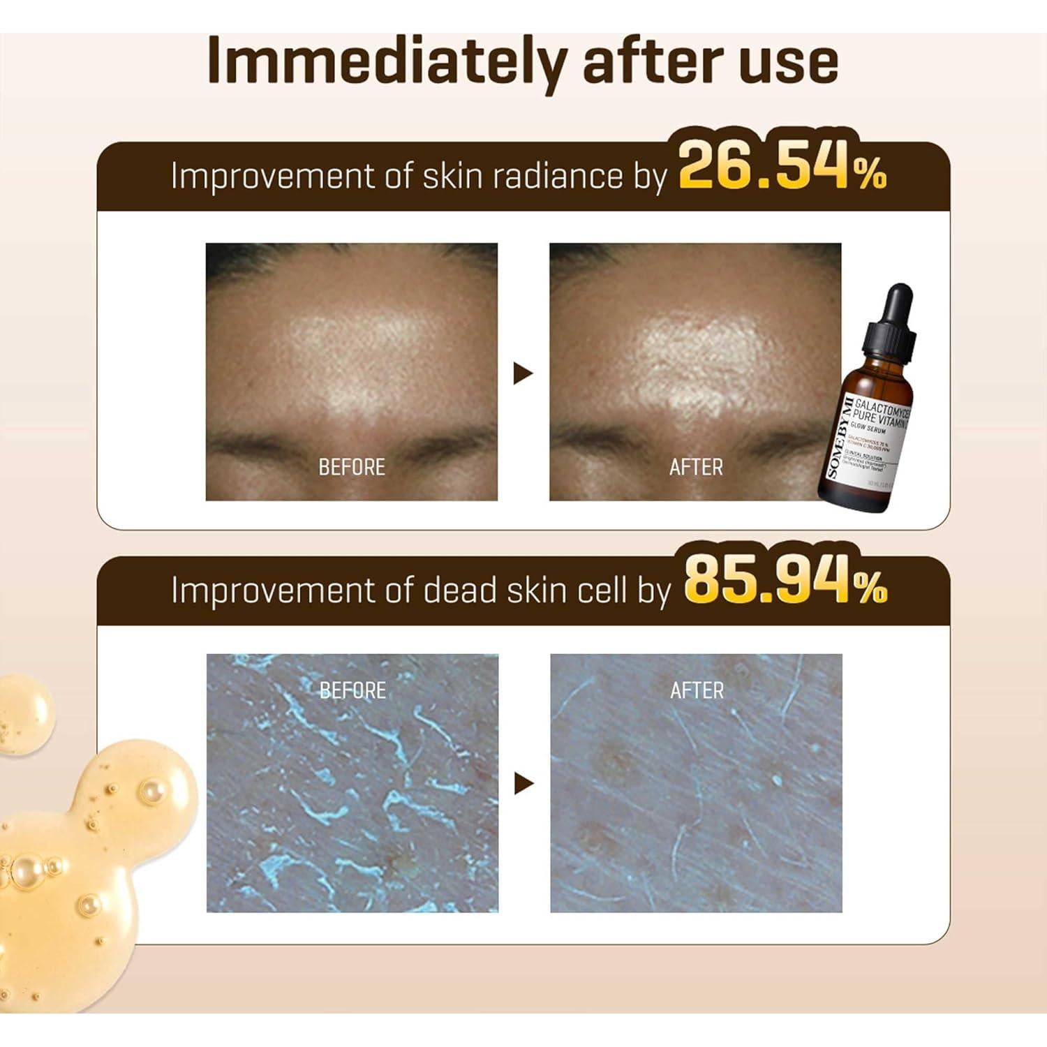 Suero Facial SOME BY MI Vitamina C Galactomyces 30ml