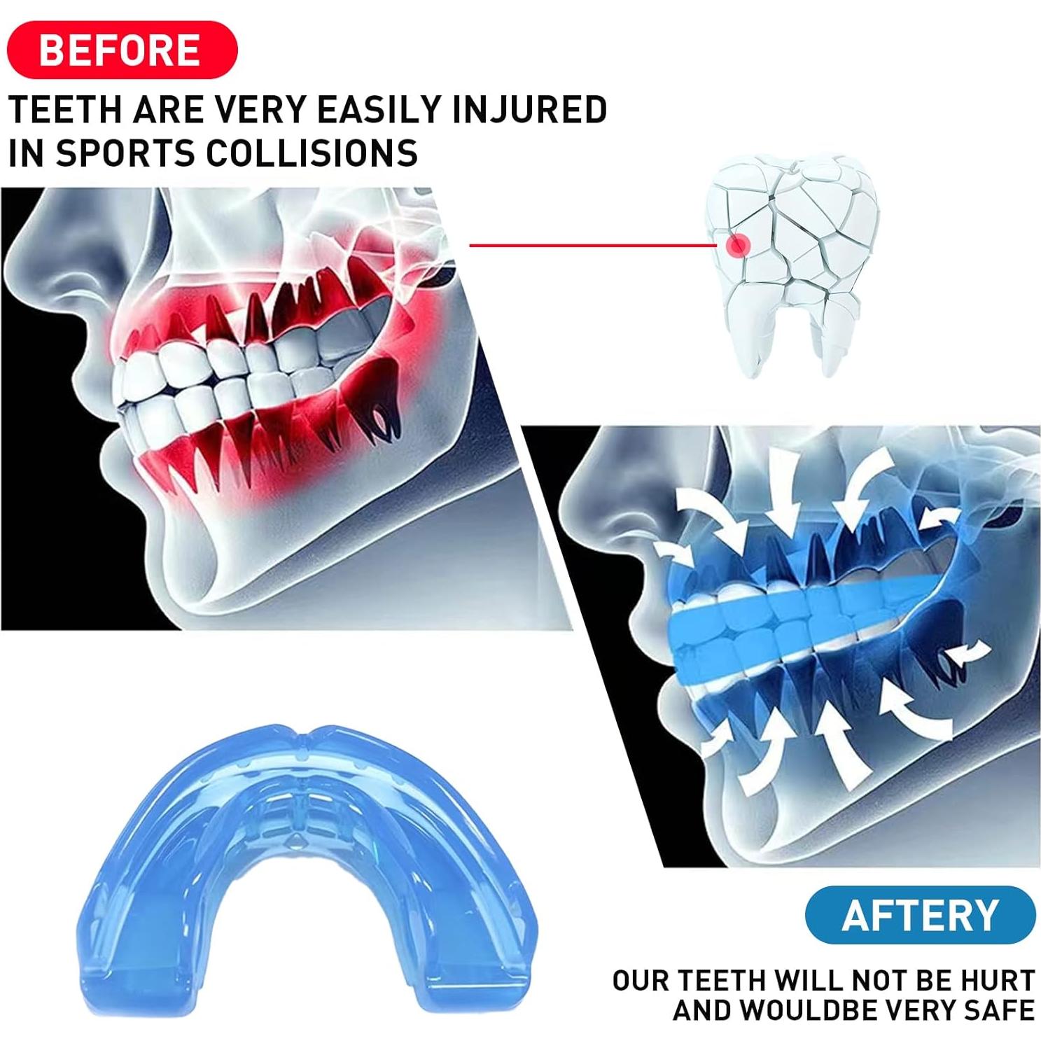 Paquete de 3 Protectores Bucales YAFIYGI para Niños Azul