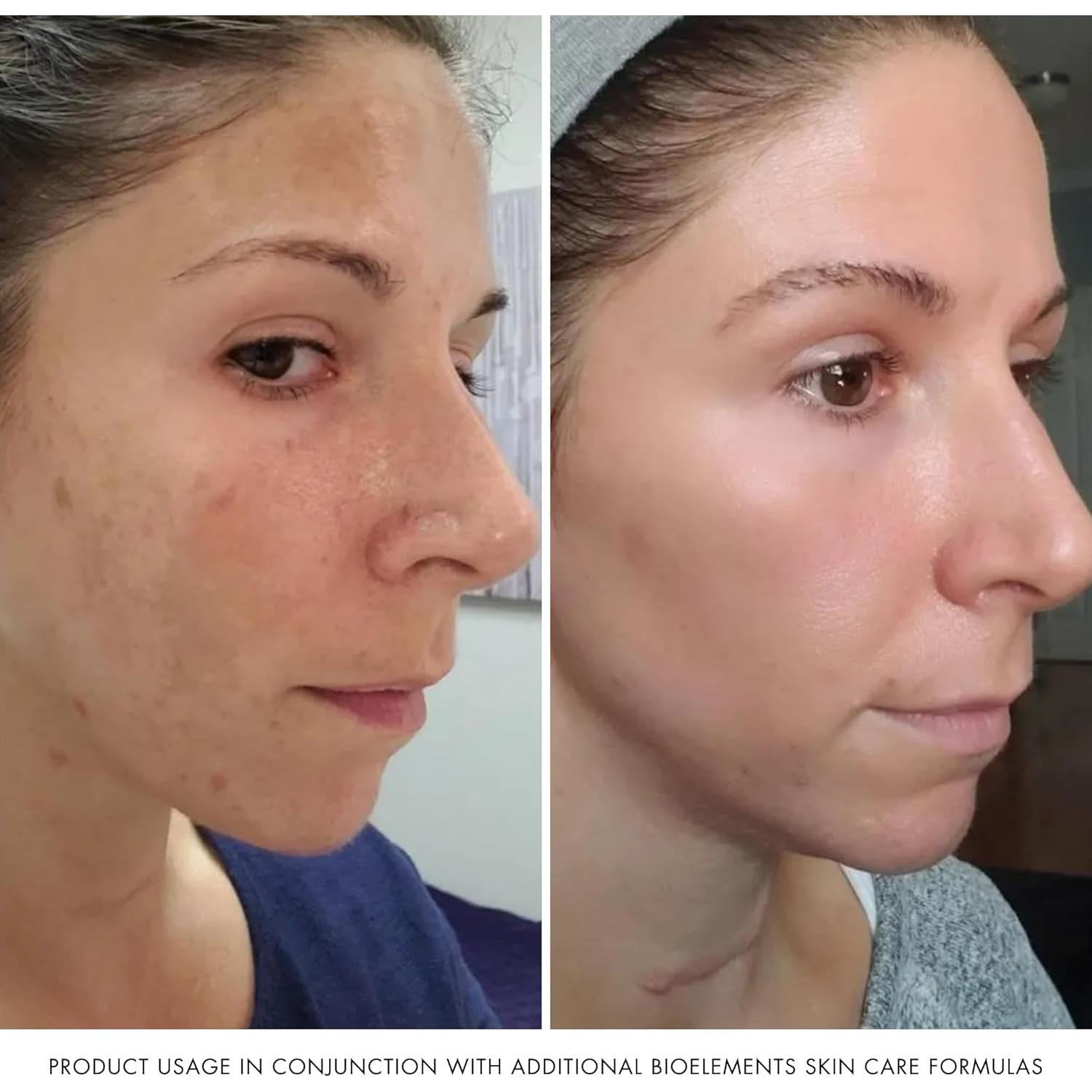 Hidratante Facial Bioelements 70g - Ligero y Vegano