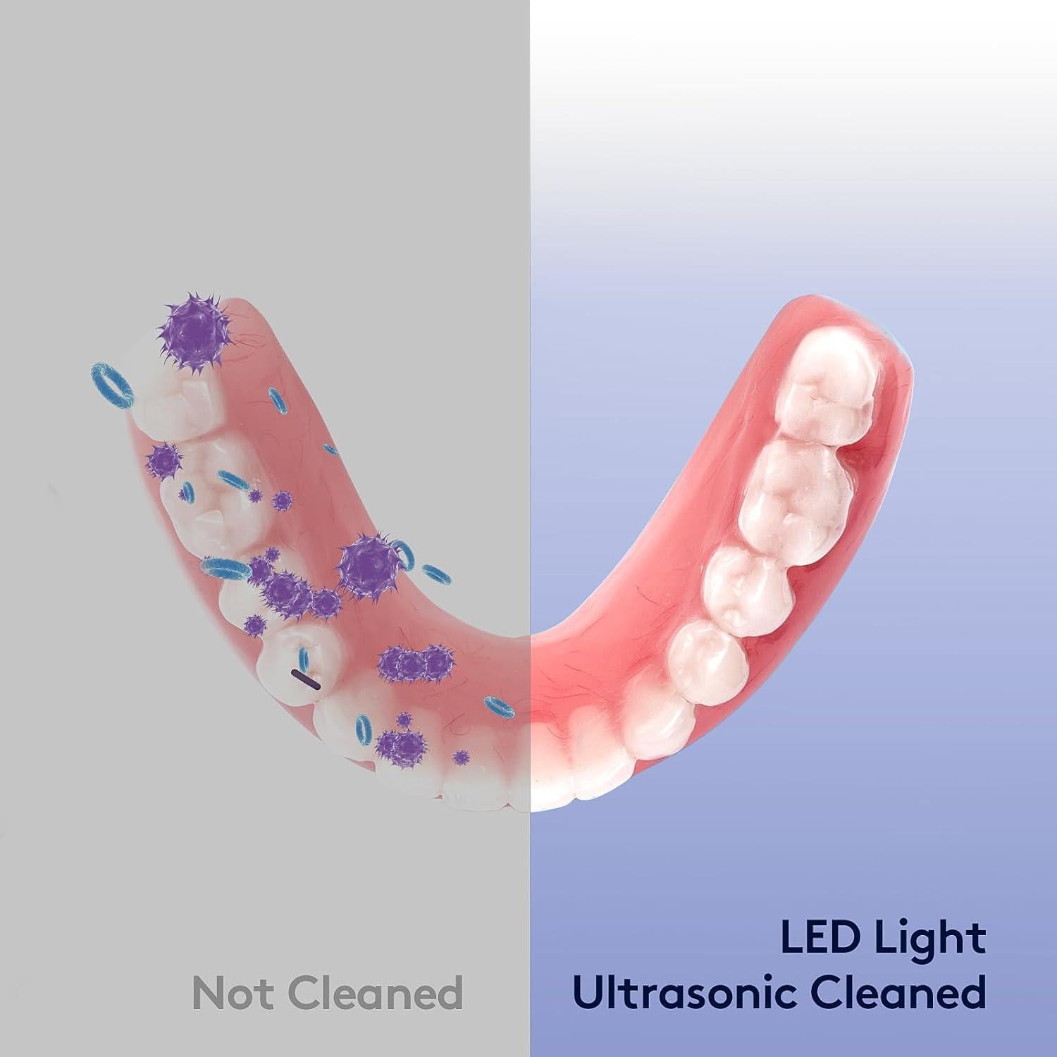 Limpiador Ultrasonico de Retenedores MySmile 200ML con Luz UV