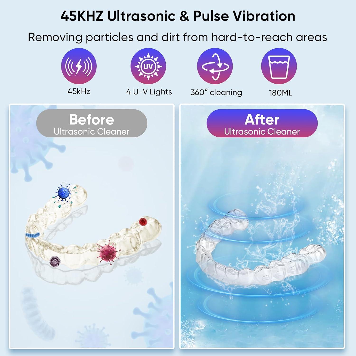 Limpiador Ultrasónico de Retenedores KEYGO 180ML 45kHz Negro