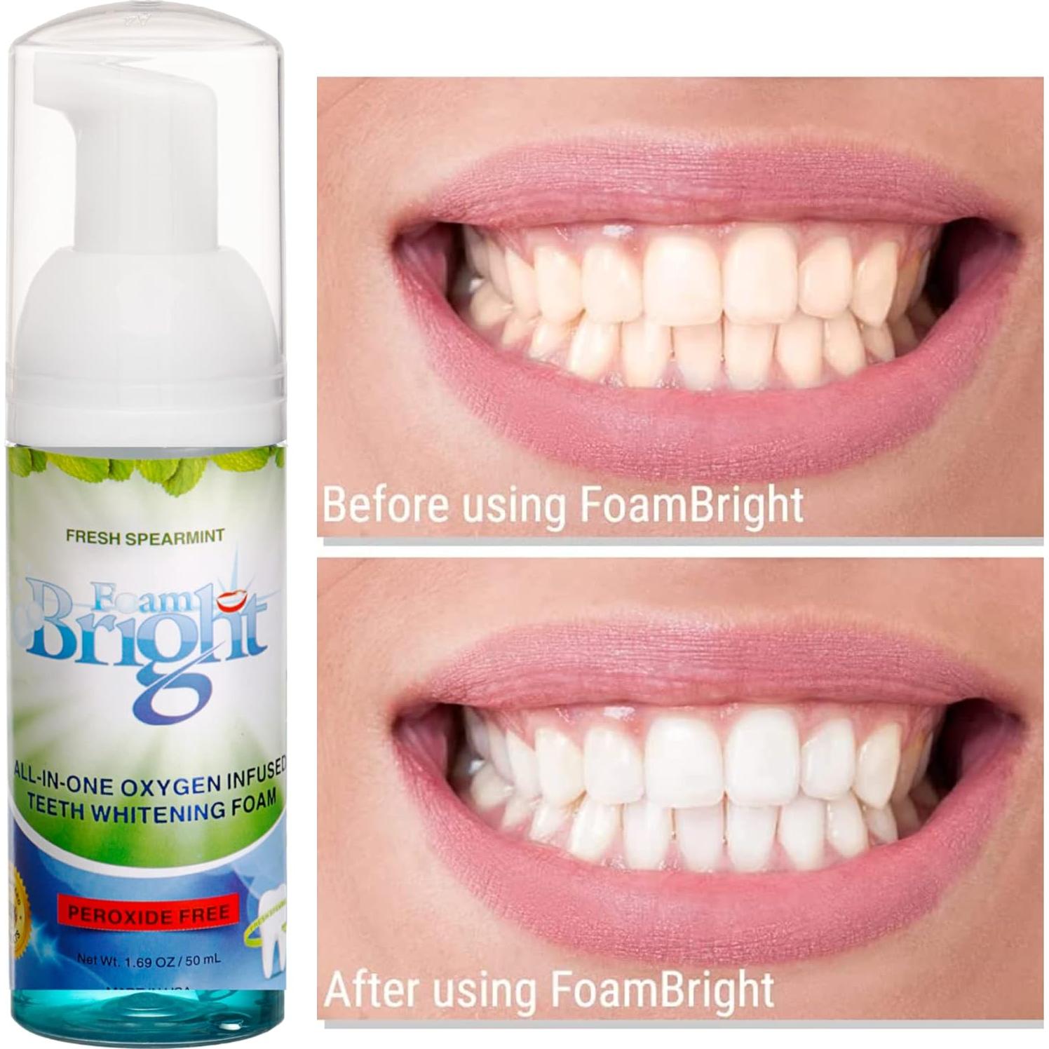 Limpiador Espumoso FoamBright para Alineadores y Dientes 199g