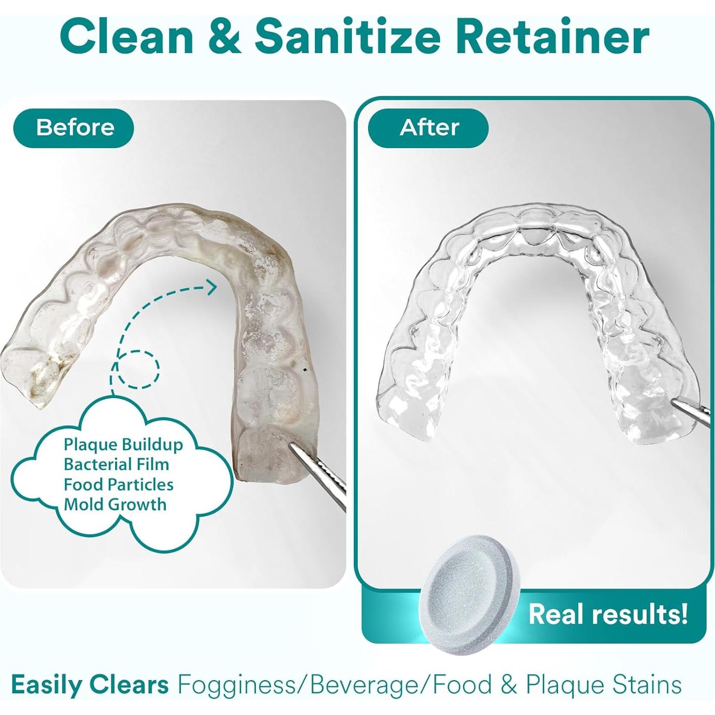 Tabletas Limpiadoras Weiss Naturals para Retenedores 120 Unidades