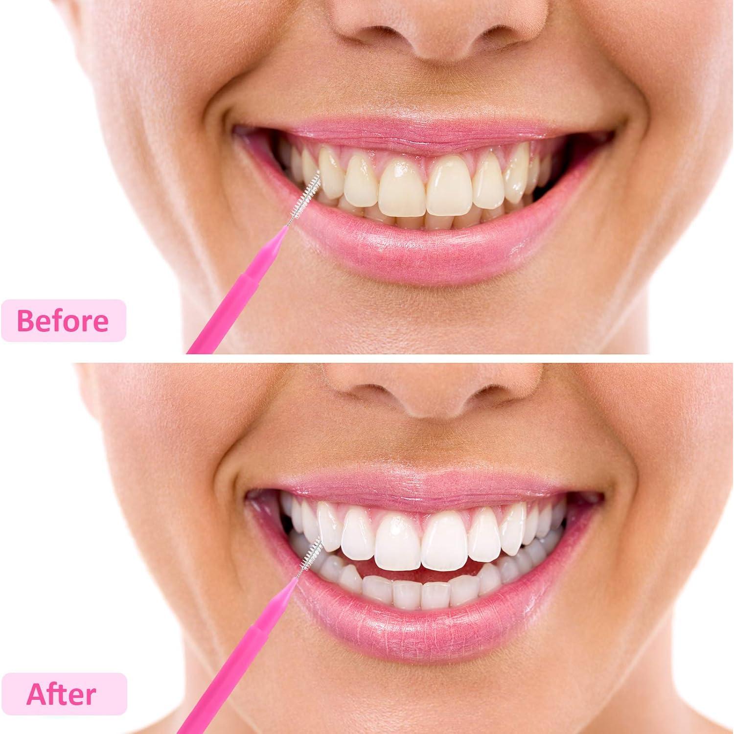 Cepillos Interdentales Patelai 100 Piezas Colores Brillantes