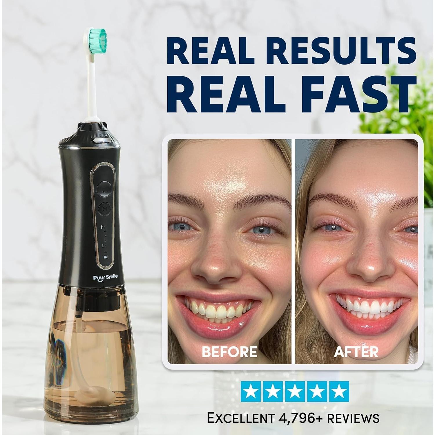 Hilo Dental a Presión Puur Smile - Irrigador Oral Recargable