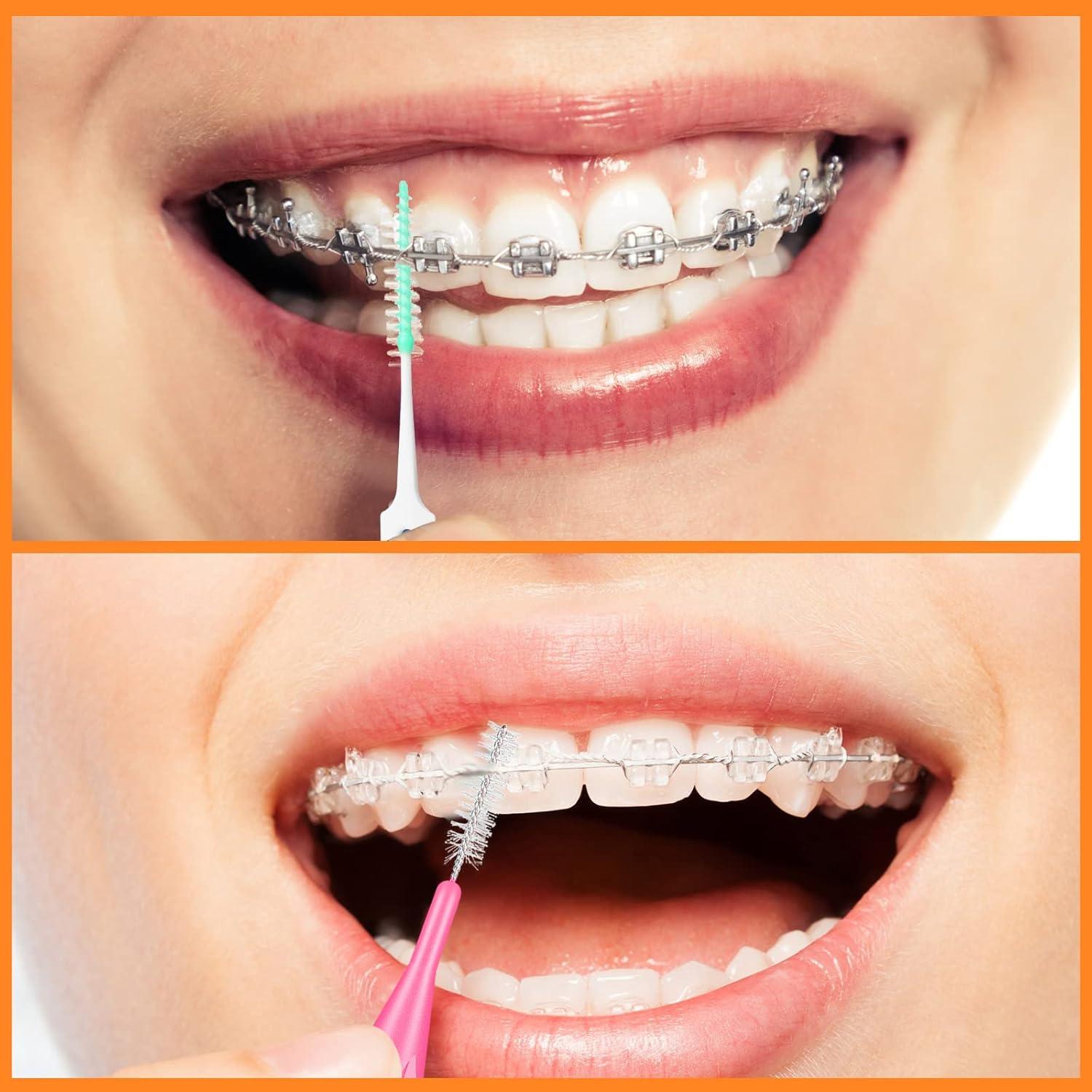 Zopeal 250 Piezas Cepillos Interdentales y Hilo Dental