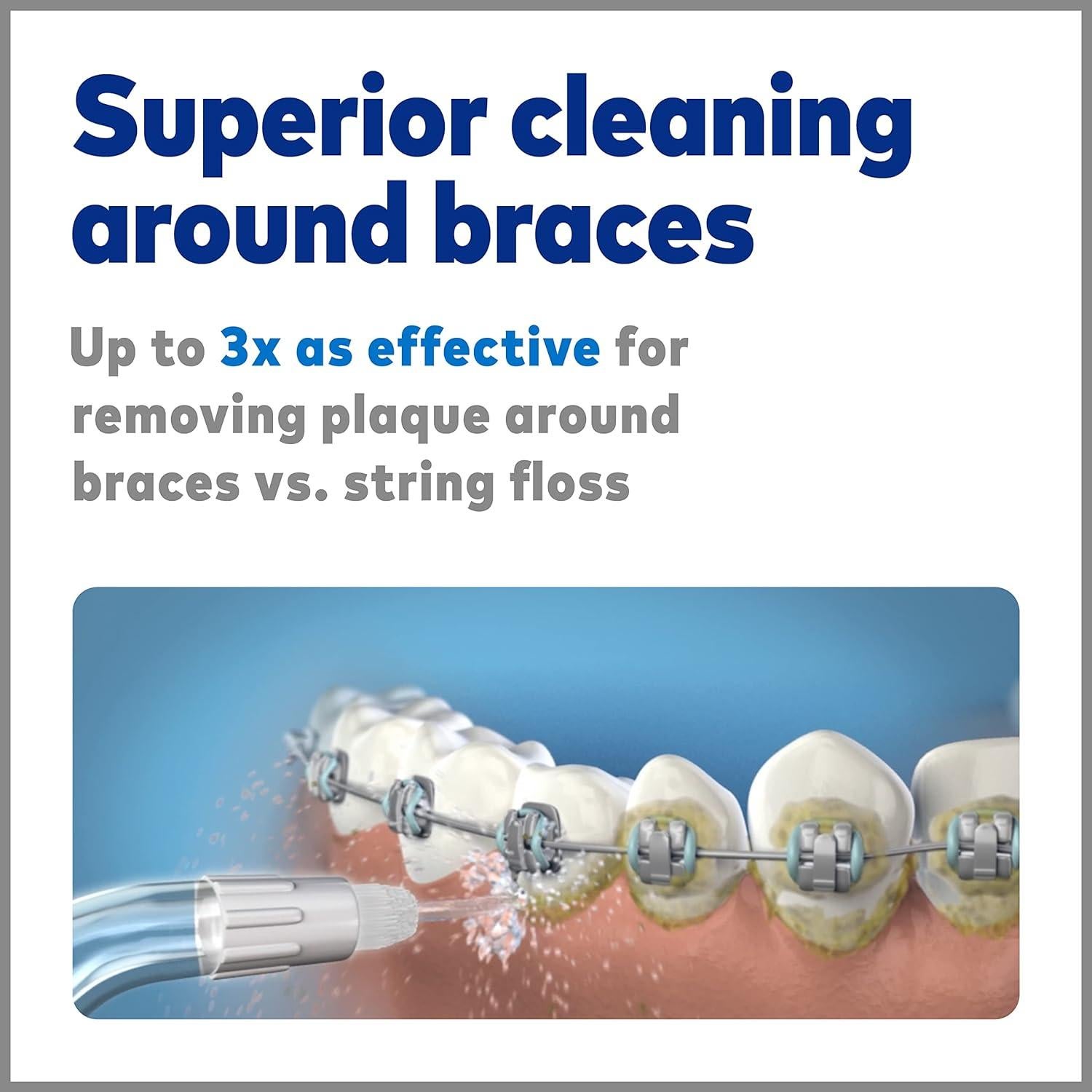 Consejos de Reemplazo Waterpik OD-100E para Brackets Dentales