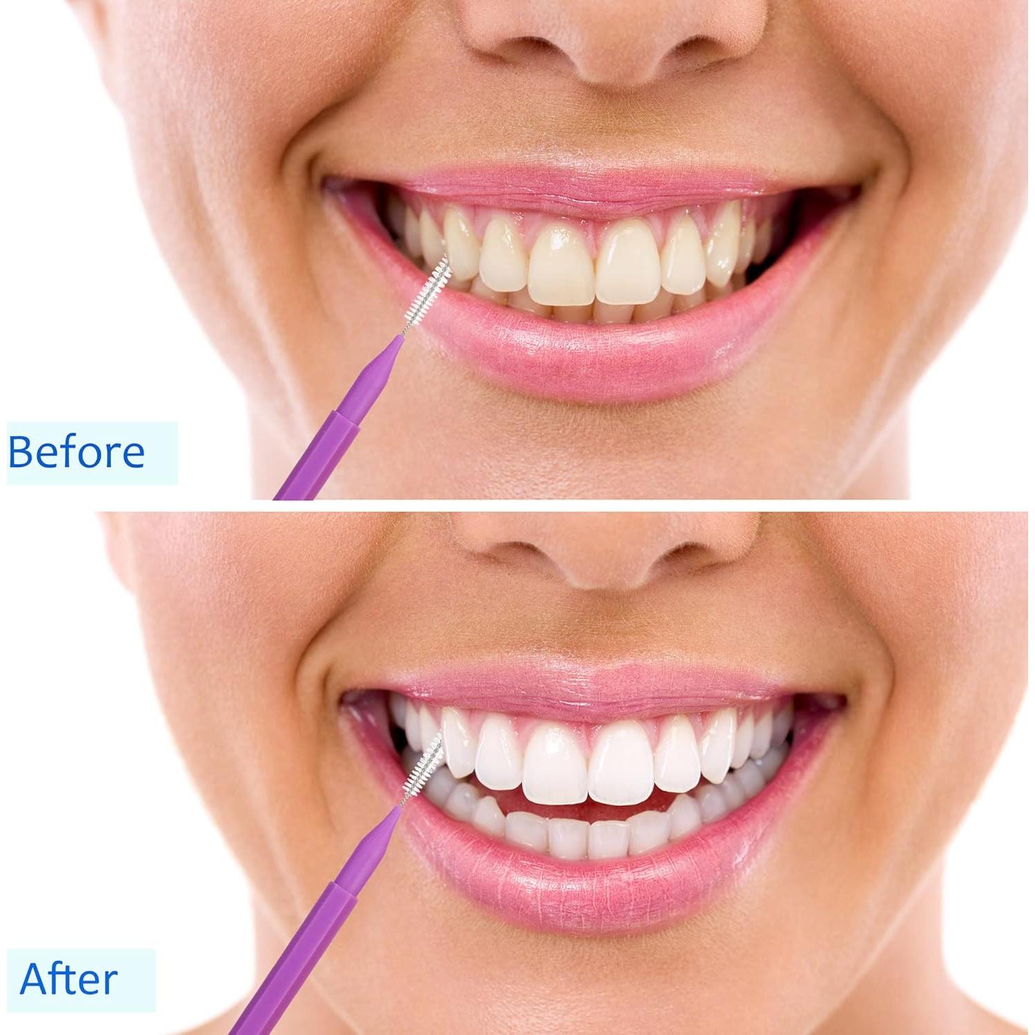 100 Piezas Cepillos Interdentales Patelai - Higiene Oral Completa