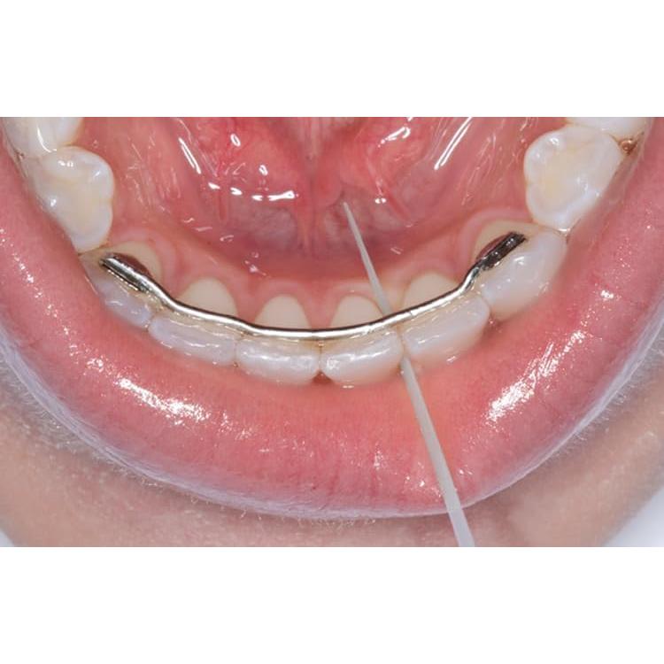 Palillos Dentales Opalpix 32 Unidades Cuidado Oral Suave