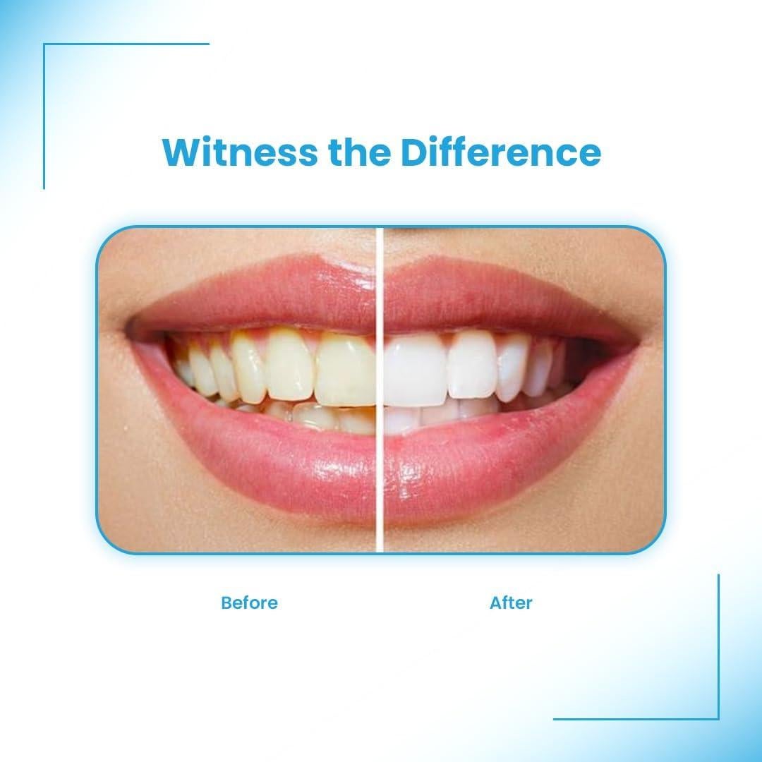 Limpiador Espuma Blanqueadora de Retenedores Alignerco 0.45kg