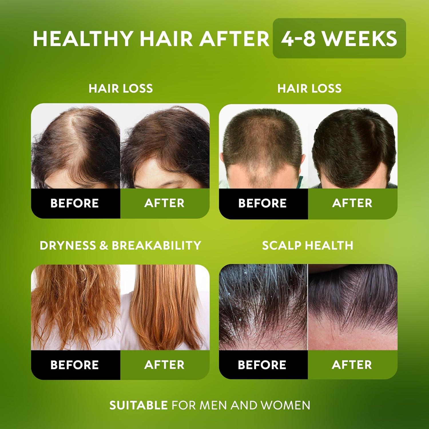 Aceite de Batana RICHGRAND 100% Orgánico para Crecimiento Capilar