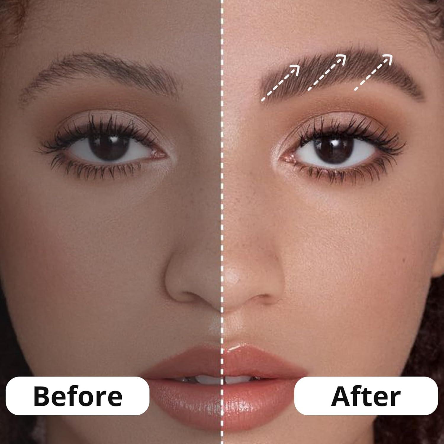 Limpiador Ultrasónico de Retenedores ELVASO 2000mAh Portátil