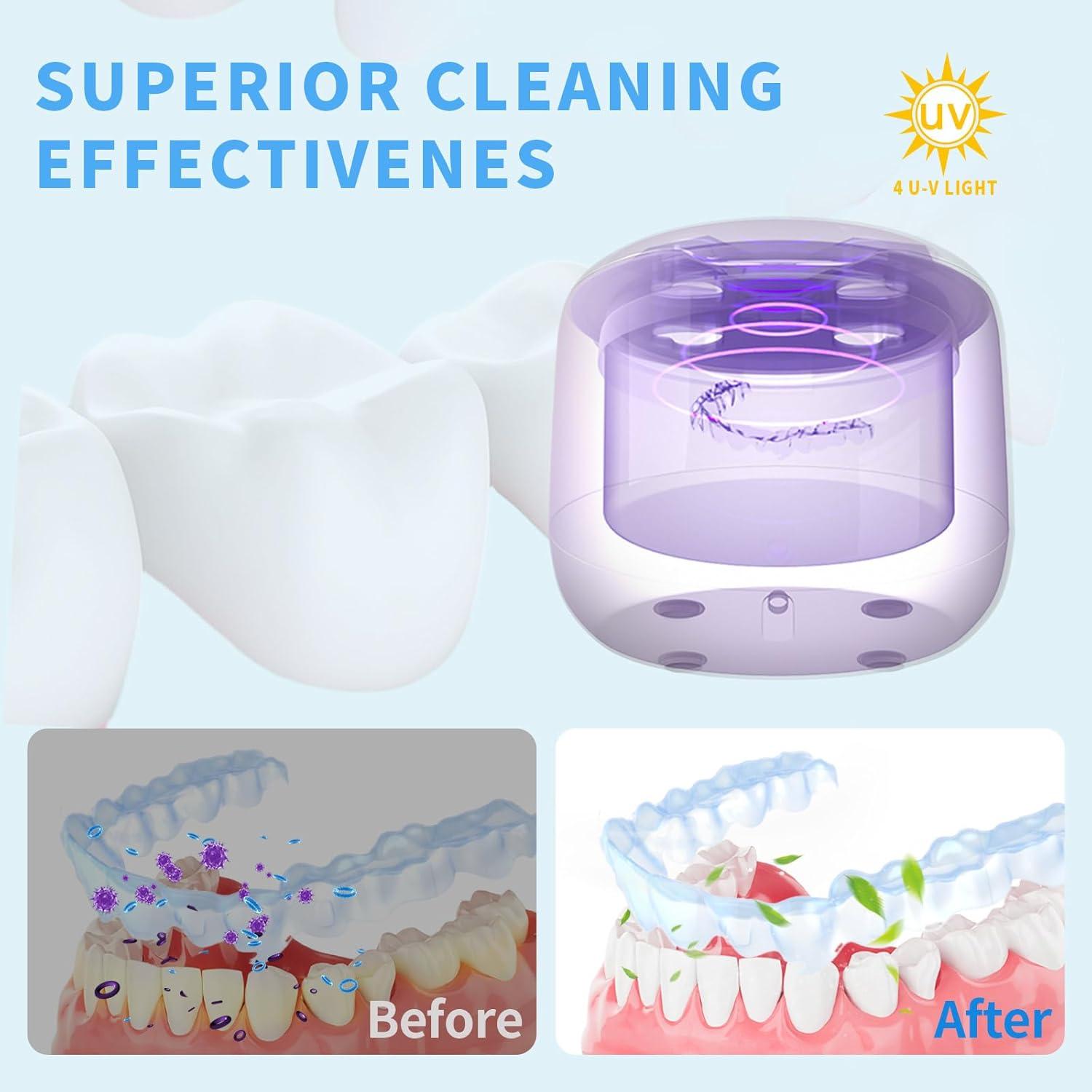 Limpiador Ultrasónico ZONIX 300ML para Retenedores y Joyería