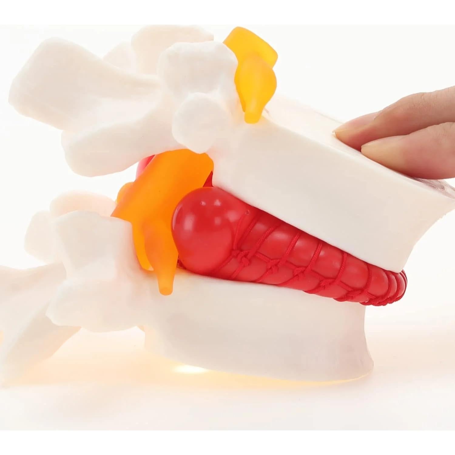 Modelo de Herniación del Disco Lumbar LYOU - 10x10 cm