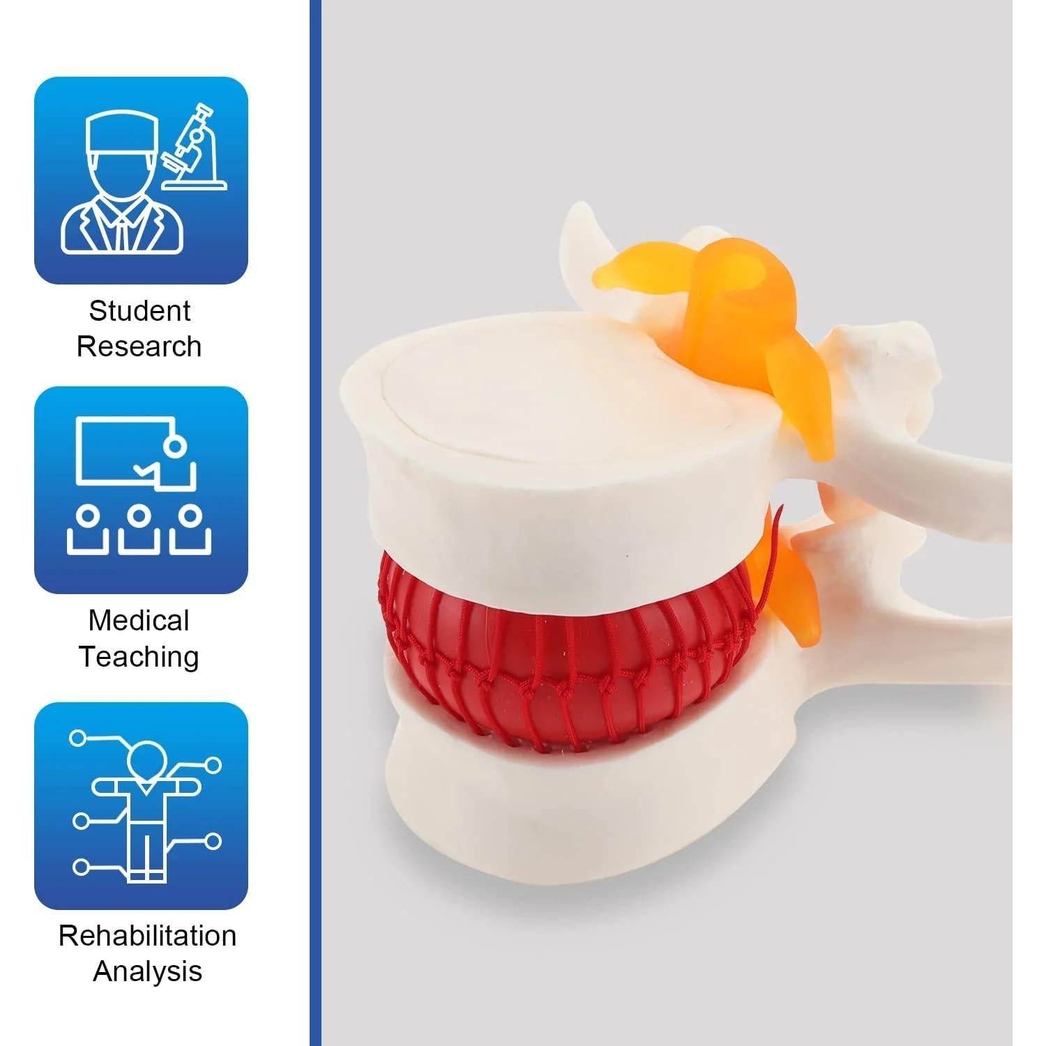 Modelo de Herniación del Disco Lumbar LYOU - 10x10 cm