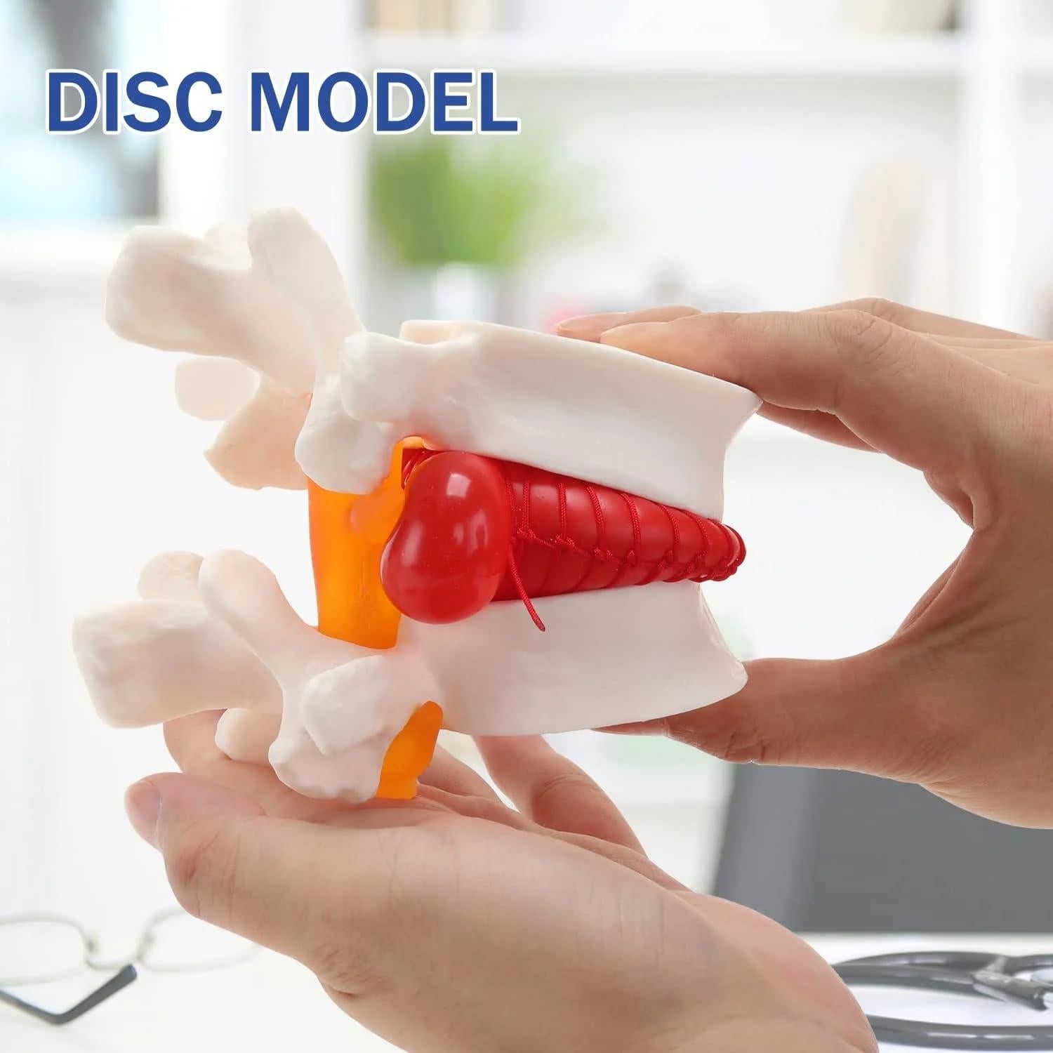 Modelo de Herniación del Disco Lumbar LYOU - 10x10 cm