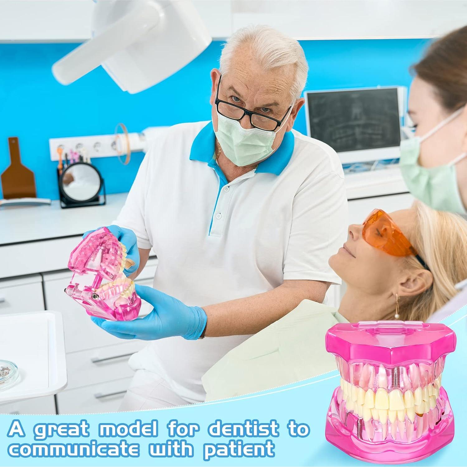 Modelo de Dientes Patológicos Rosa Outus para Educación Dental