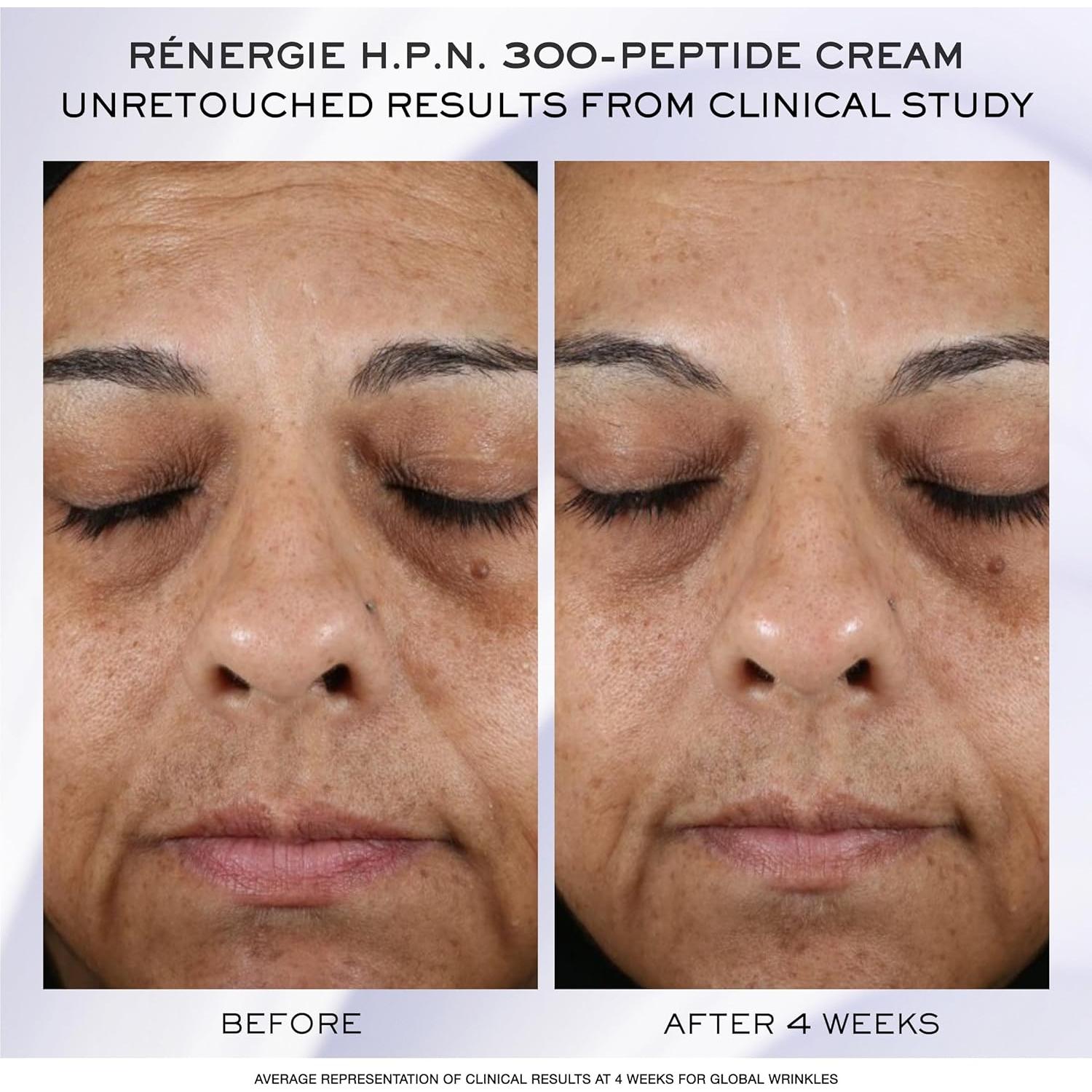 Set de Descubrimiento Suero Triple Lancôme 149g