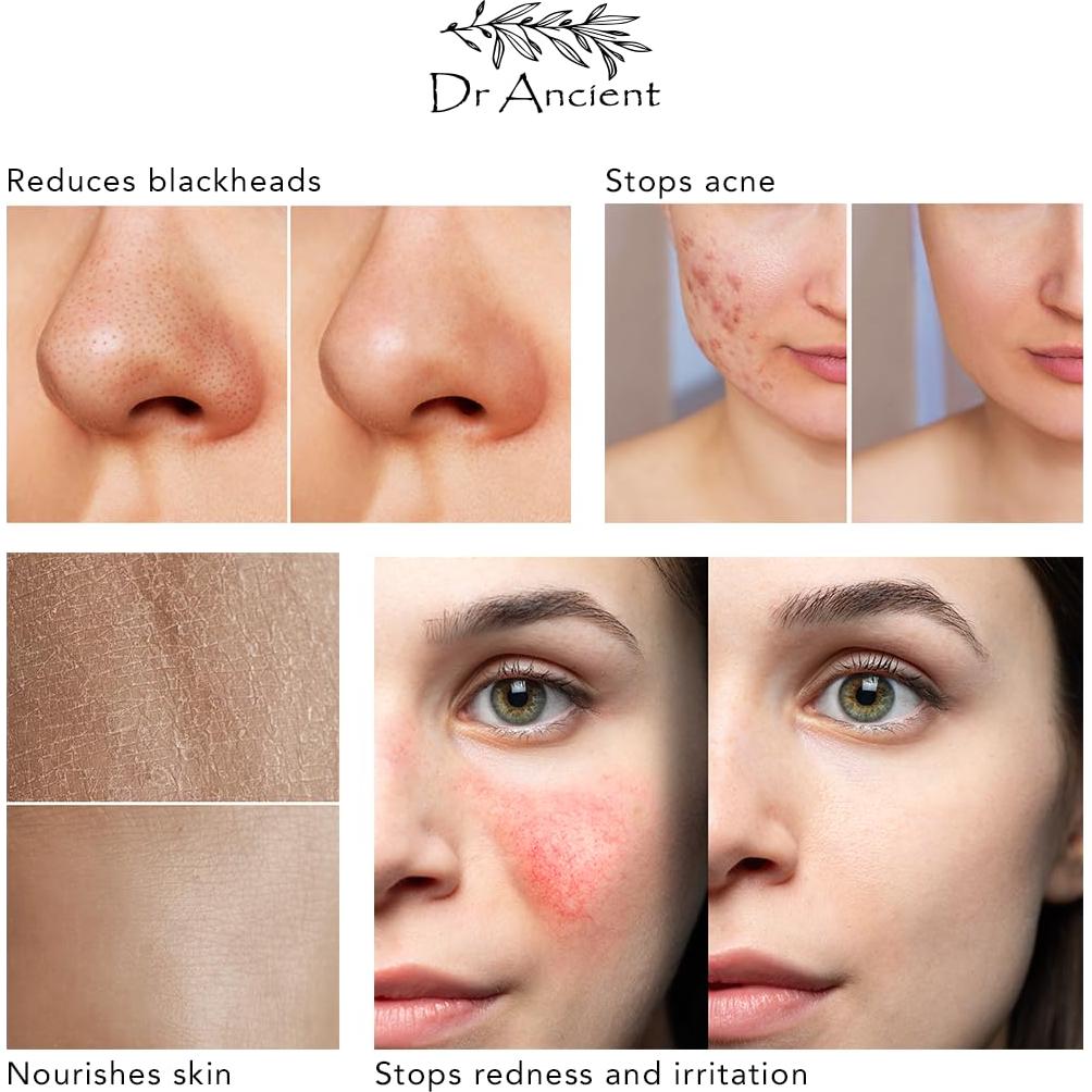 Jabón Natural de Aloe Vera Orgánico Dr.Ancient 140g Hecho a Mano