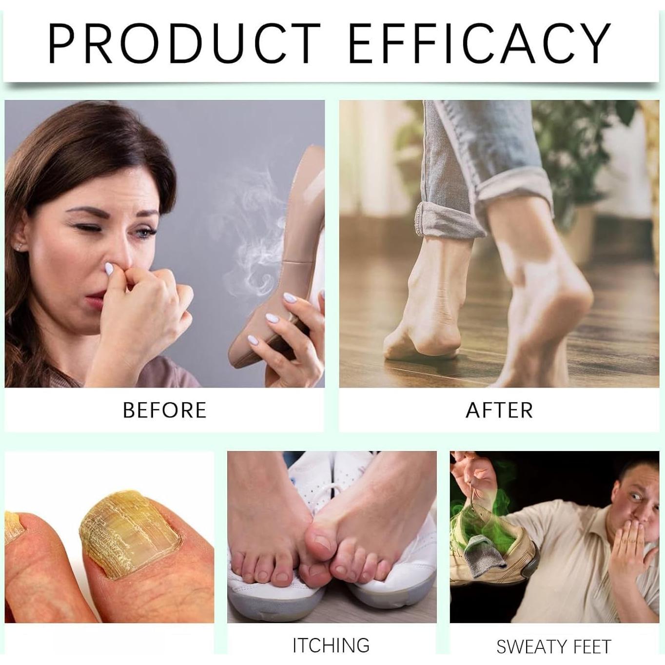 Spray Desinfectante para Pies Shantou Ximonth 100ml Aceite de Árbol de Té