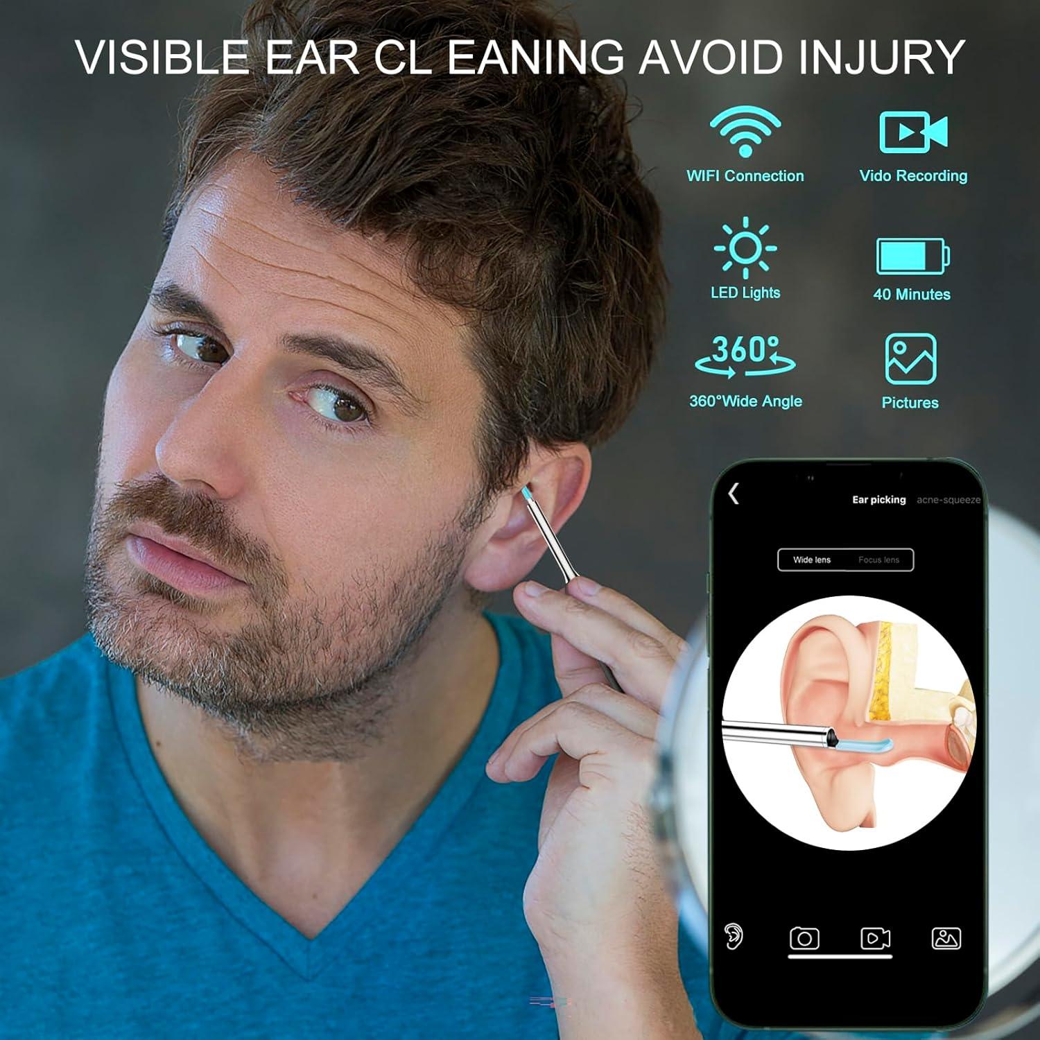 Limpiador de Cerumen Inalámbrico GOLDFOX con Cámara HD 1080P