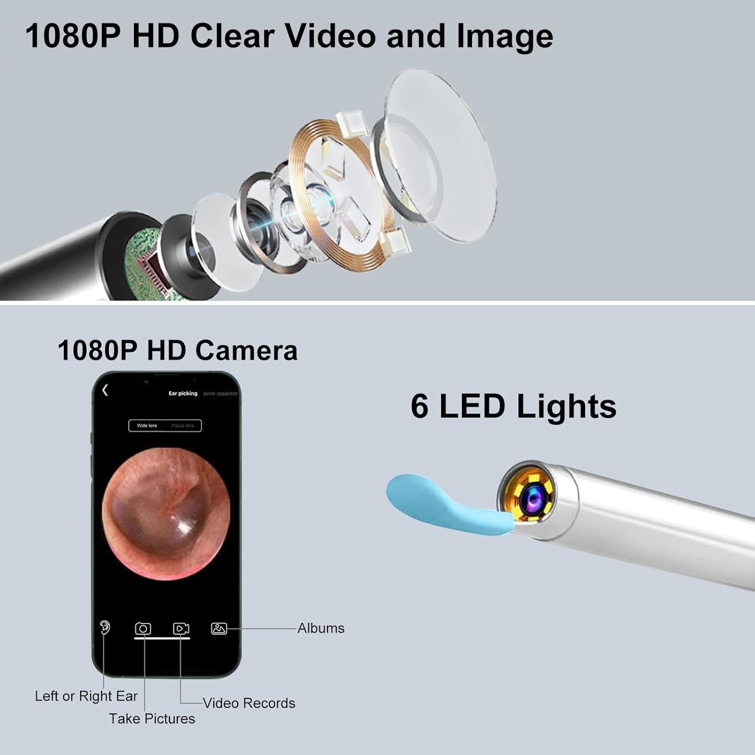 Limpiador de Cerumen Inalámbrico GOLDFOX con Cámara HD 1080P