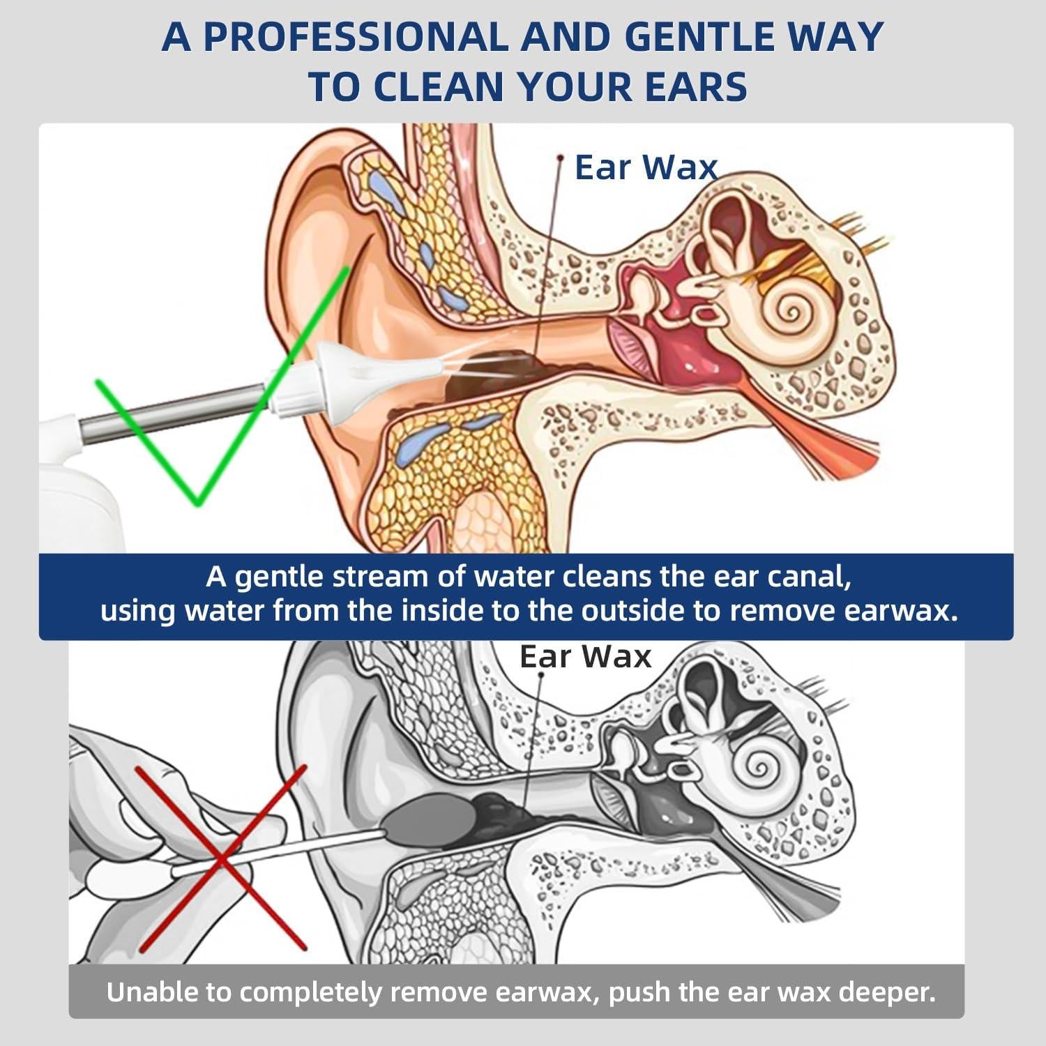 Limpiador de Oídos Eléctrico MIORIT a Base de Agua IPX7