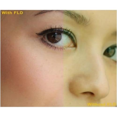 Kit de Filtros de Lente 62mm Digital Nc para Sony SAL-1680Z