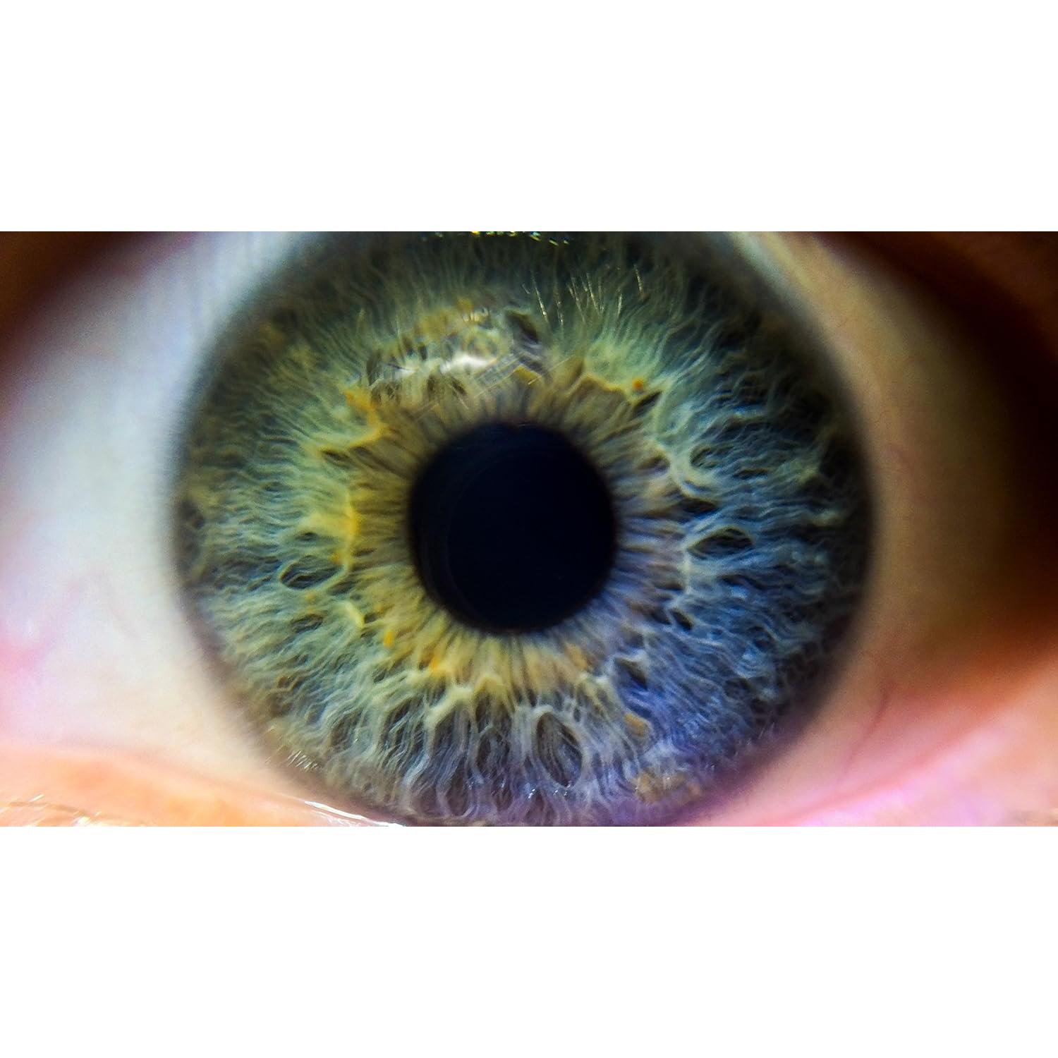 Lente de Acercamiento Digital Nc +10 62mm para Pentax K-70