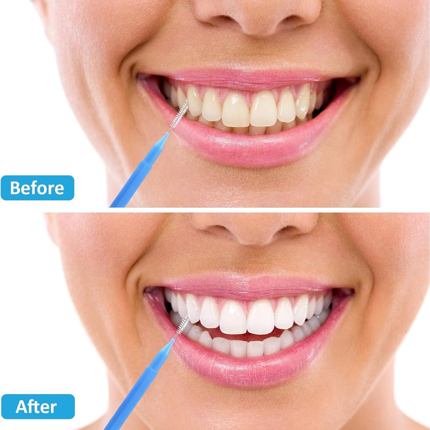 Cepillos Interdentales Patelai 100 Piezas Colores Variados