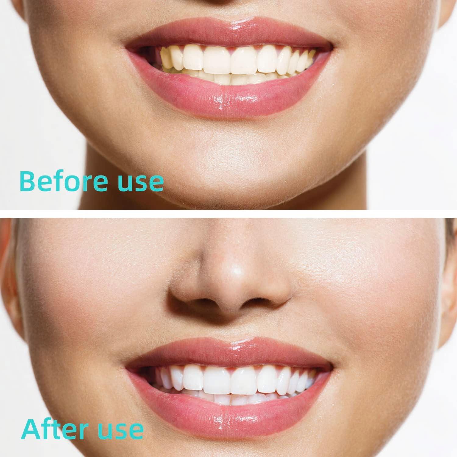 Cepillos Interdentales Desechables GOUWEIBA 100 Piezas Azul y Rojo