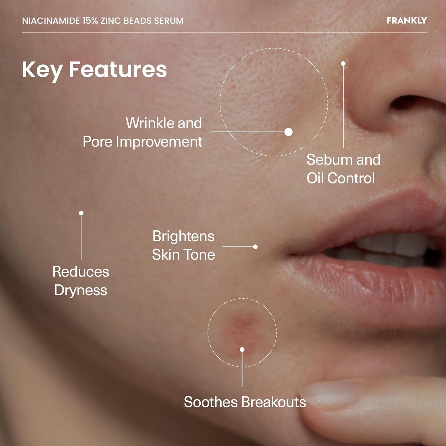 Suero Niacinamida 15% + Zinc Frankly 30 ml - Control Acné y Poros