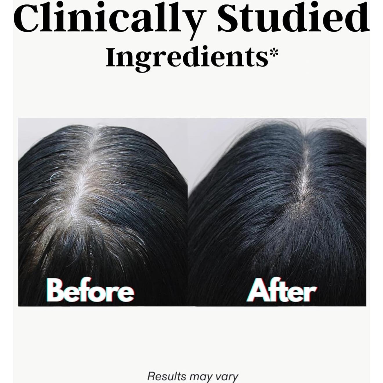 Suplemento Antienvejecimiento Cabello Gris Rescindir 60 Cápsulas