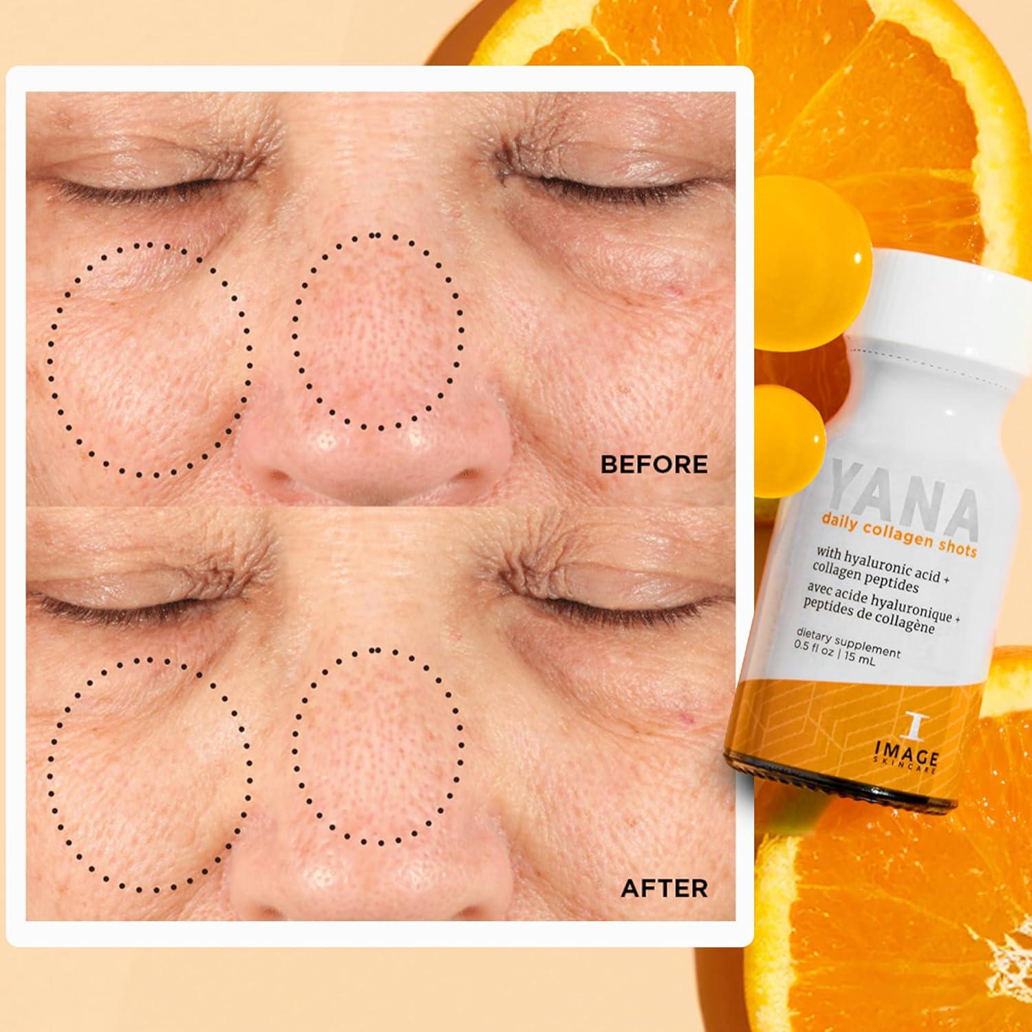 Disparos de Colágeno Líquido YANA IMAGE Skincare 2500 mg