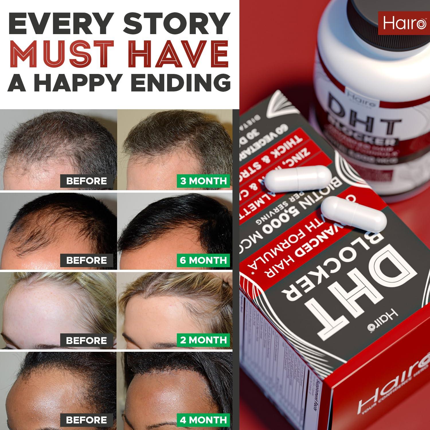 Suplemento Crecimiento Cabello Hairo Nutrition DHT Blocker 236.6ml