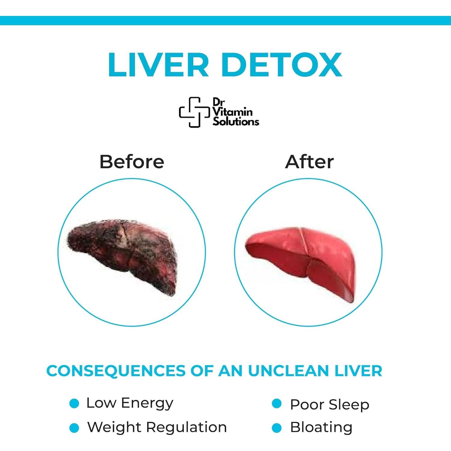 Suplemento Hepático Vegano SOLUCIONES VITAMINICAS DR 30 Cápsulas