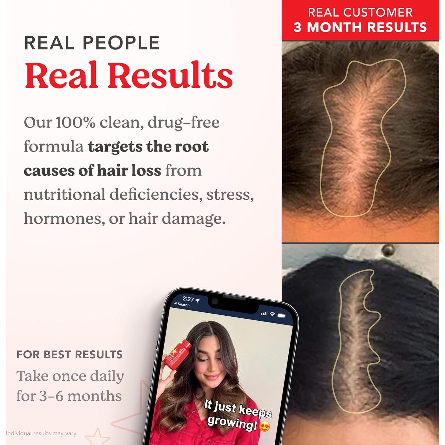 HAIRtamin Suplemento Vegano para el Cabello 30 Cápsulas 5000 mcg