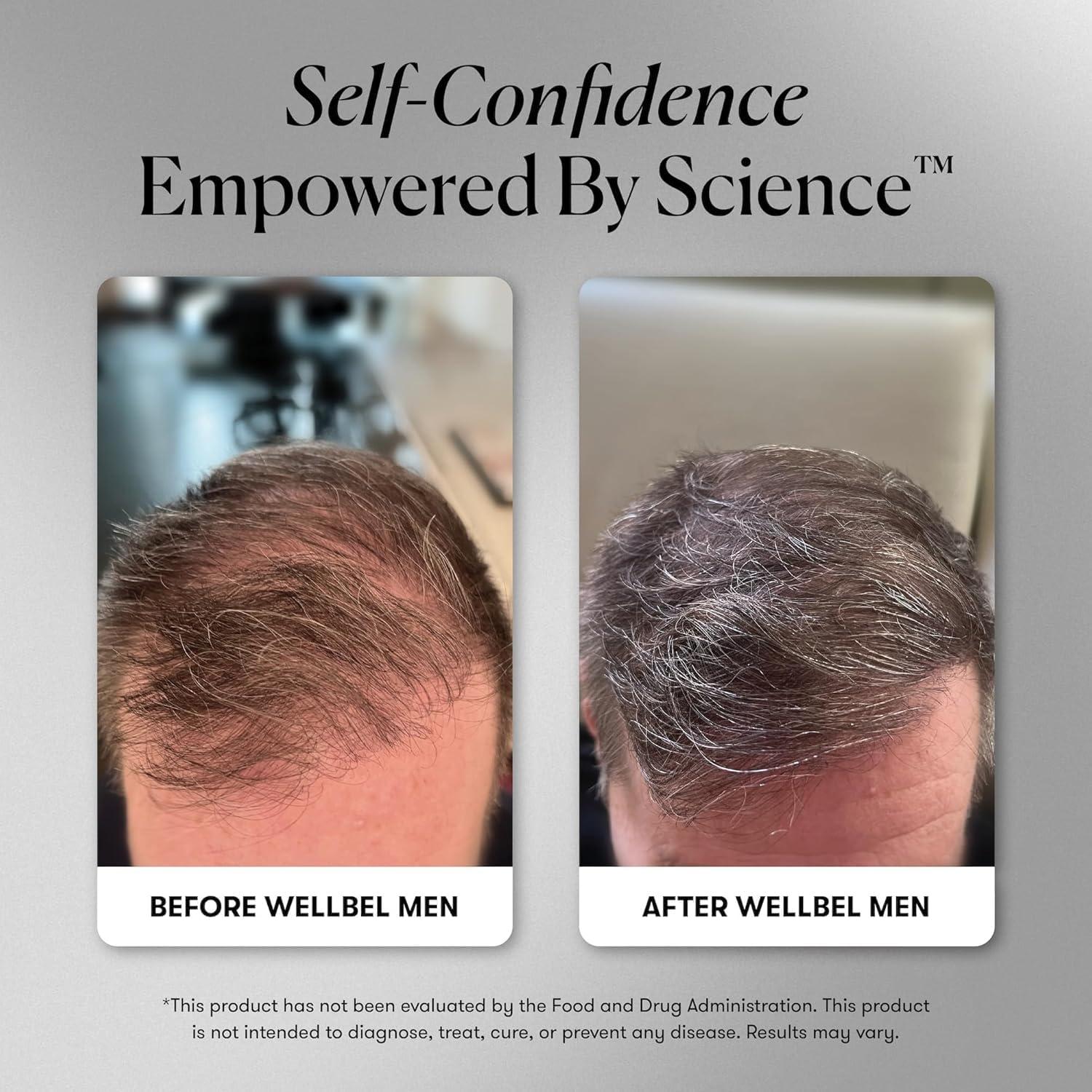 Suplemento Vegano Wellbel Hombres para Cabello, Piel y Uñas 90 Cápsulas