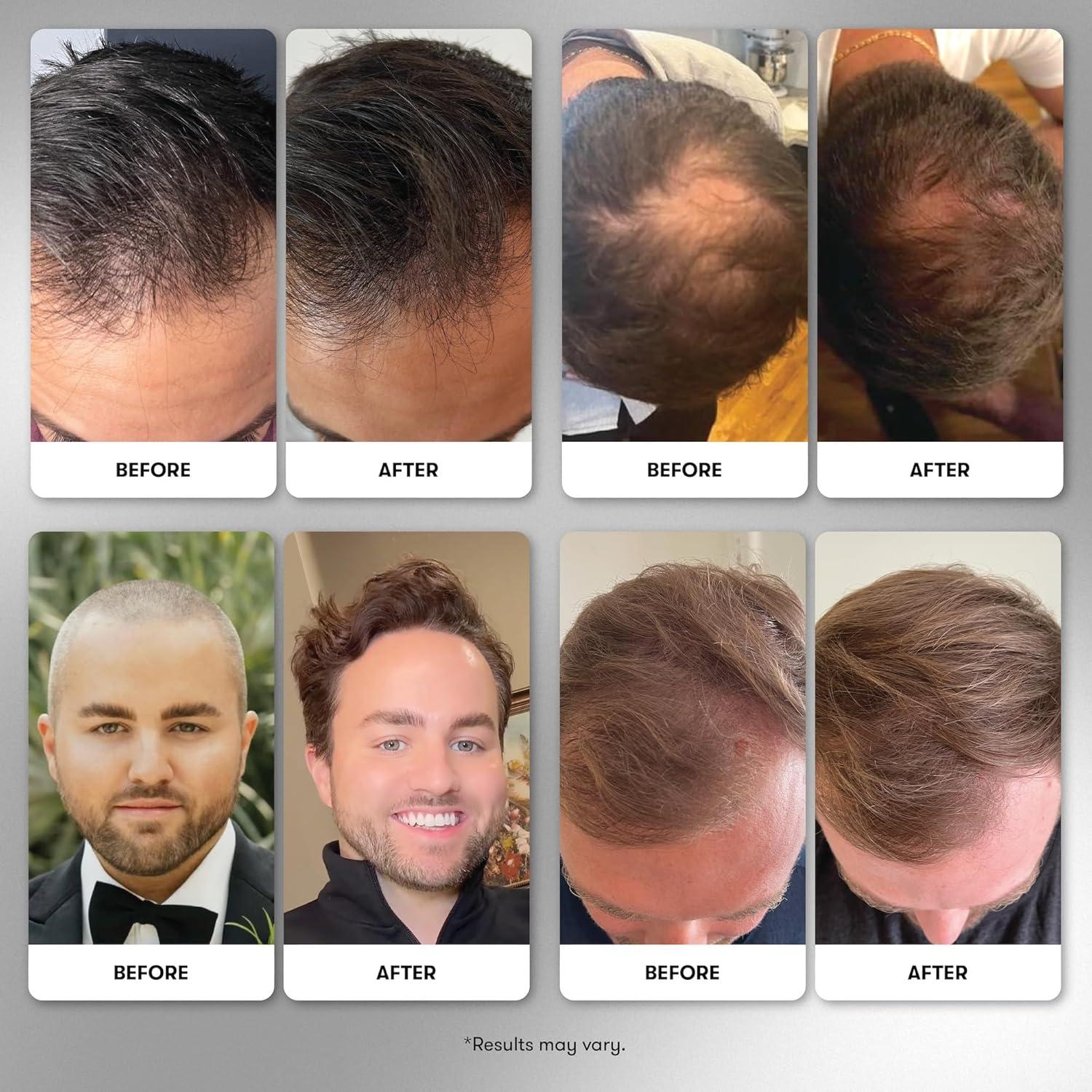 Suplemento Vegano Wellbel Hombres para Cabello, Piel y Uñas 90 Cápsulas