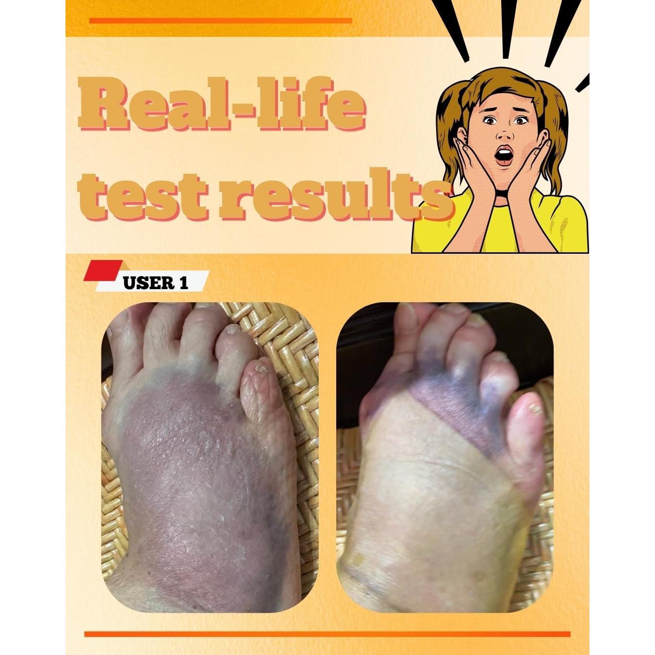 Parche Tópico de Cúrcuma y Curcumina LEADTEK - 30 Parches