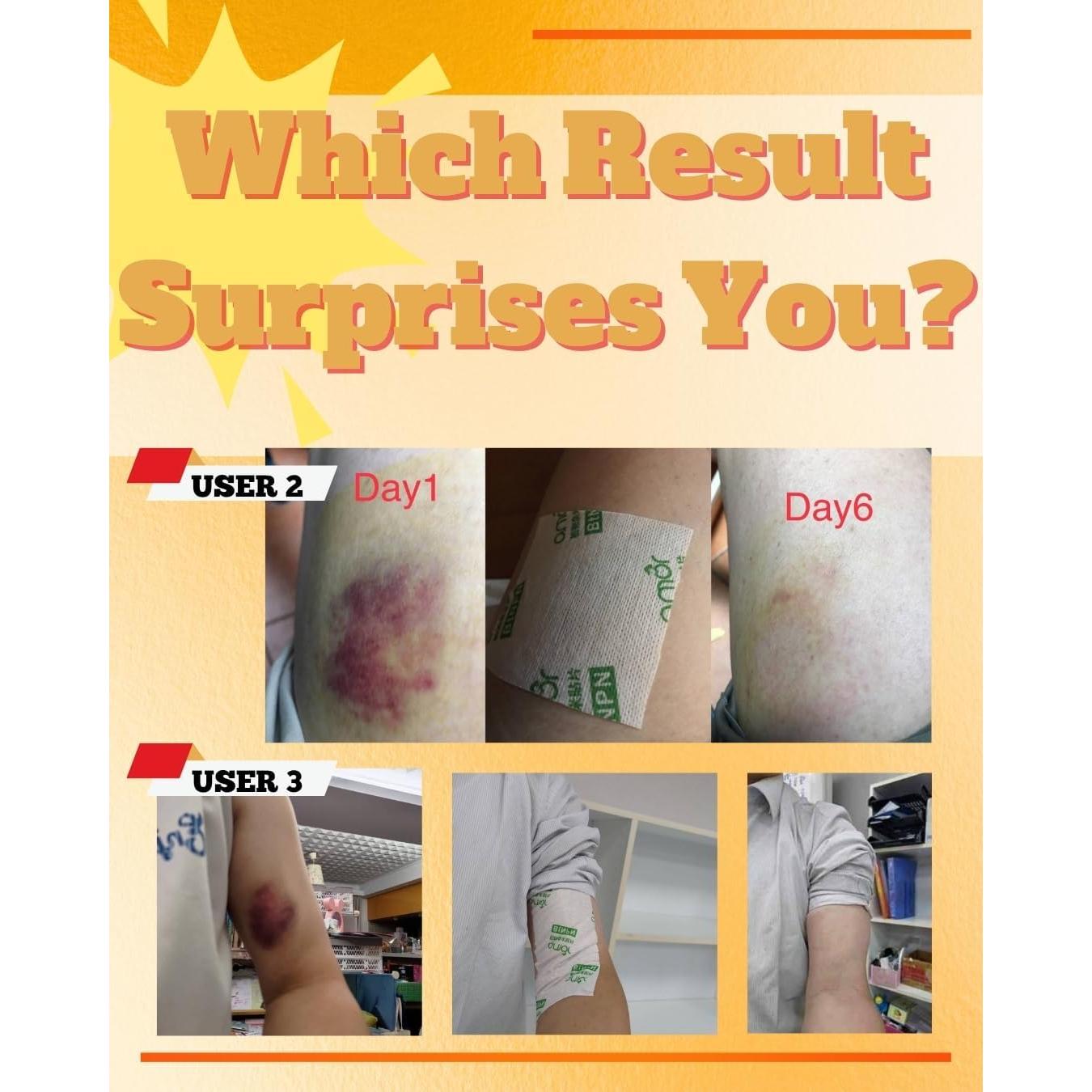 Parche Tópico de Cúrcuma y Curcumina LEADTEK - 30 Parches