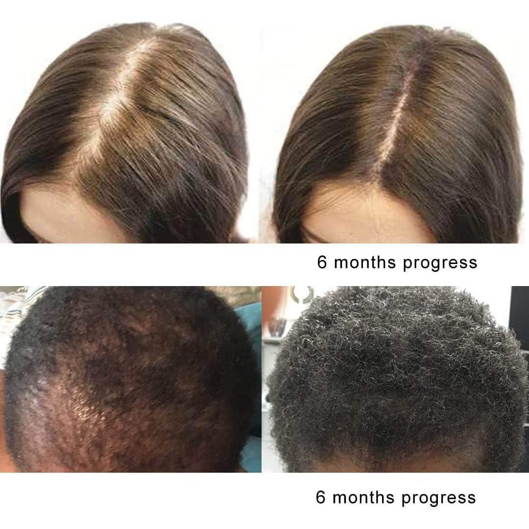 Aceite de Palma Enana Pura Orgánico 30 ml - Apoyo Prostático