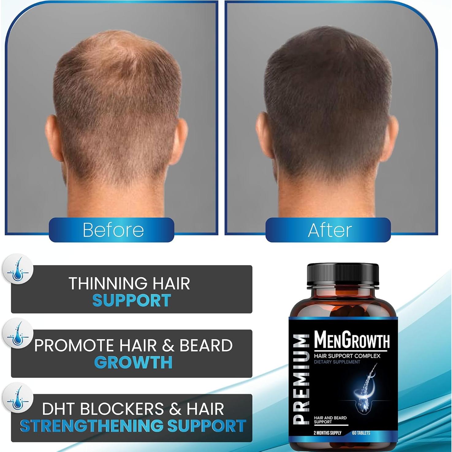 Vitaminas para Crecimiento de Cabello y Barba NutraPro 60 Tabletas